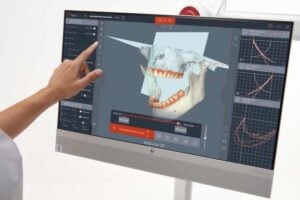 MODJAW 4D jaw tracking device used to record jaw movement and evaluate dental function at Dr. Jeffrey Cohen's Covina dental office.